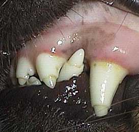 lesiones dentales